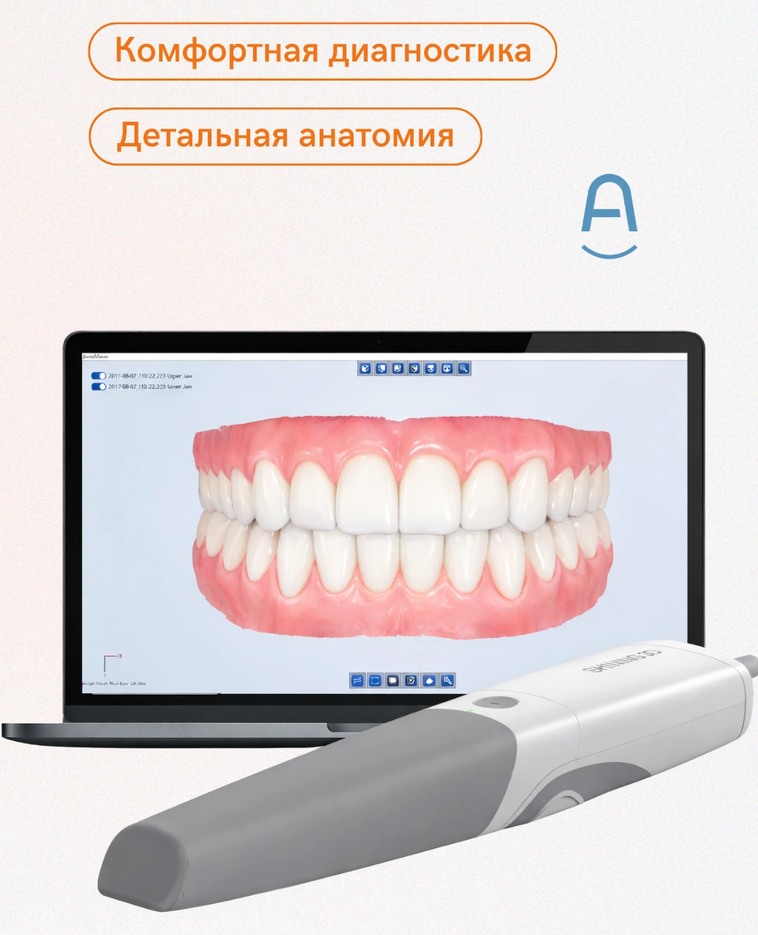 Внутриротовые сканеры